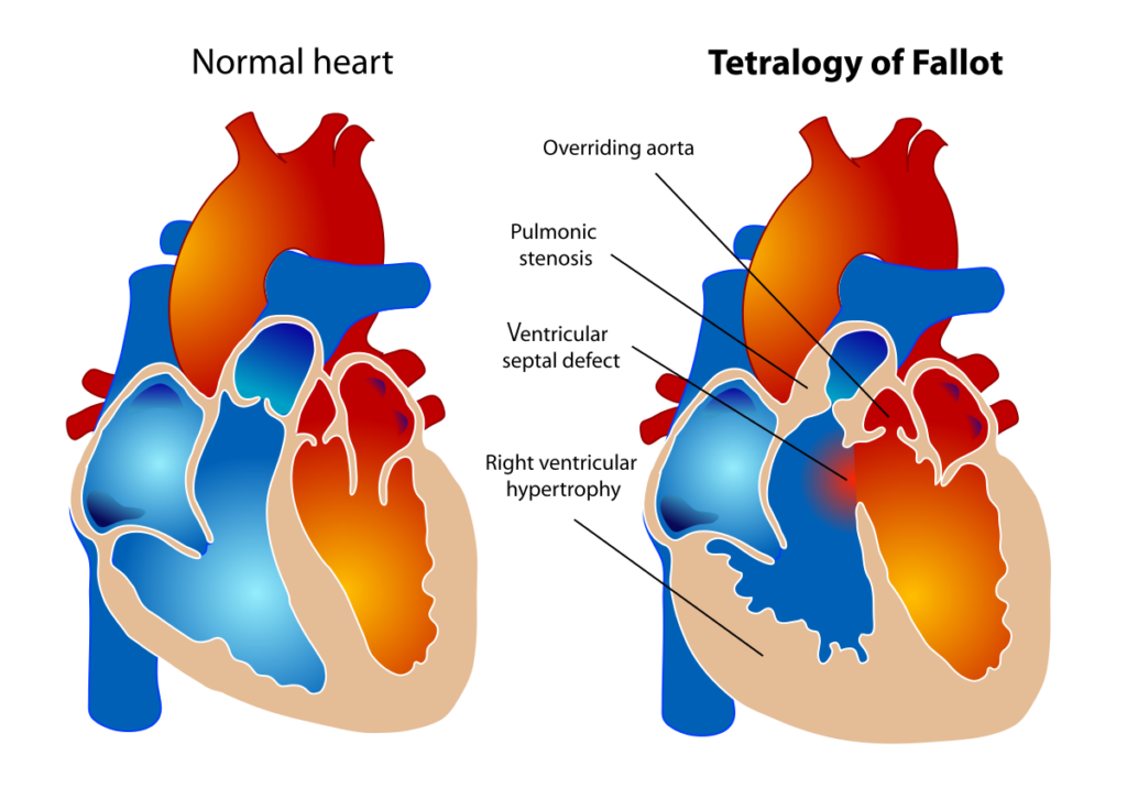 Temporary health spells